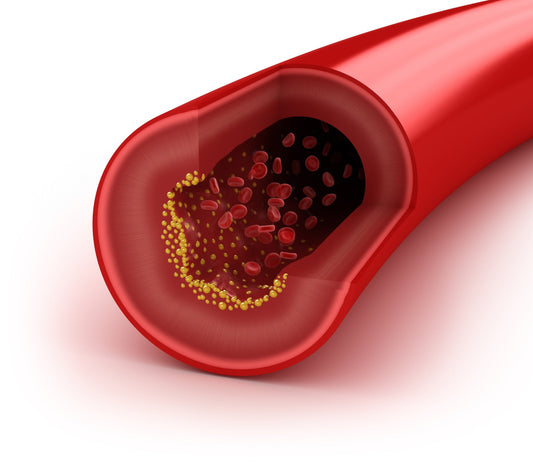 Cholesterol